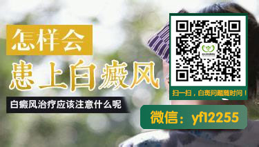 Ϊʲô˵综Է